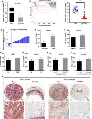 MNX1 Promotes Malignant Progression of Cervical Cancer via Repressing the Transcription of p21cip1